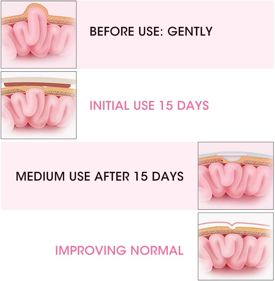 Wchiuoe Umbilical Hernia Belt, Baby Belly Button Band, 2pcs Children Infant Baby Umbilical Hernia Belt, Infant Abdominal Binder, Adjustable Baby Navel Truss Support Abdominal Belt (Pink) - Image 3